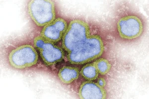 Rodzaje grypy - wszystko co trzeba wiedzieć